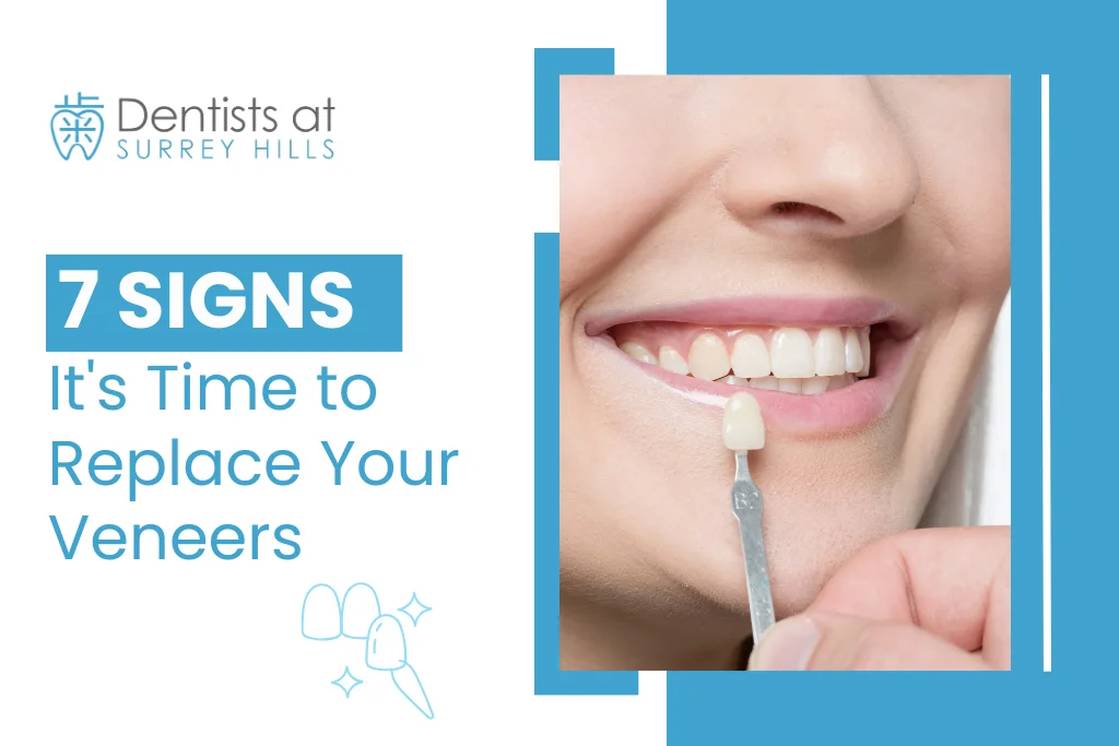 Signs You Should Replace Dental Veneers